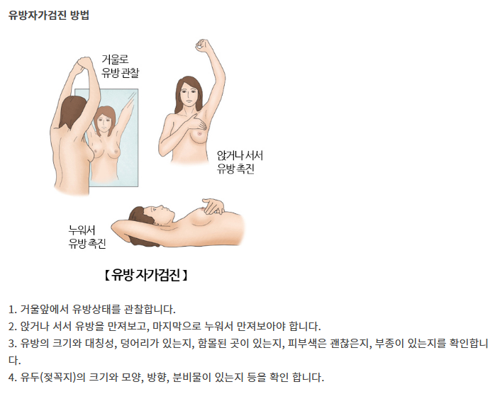 유방암